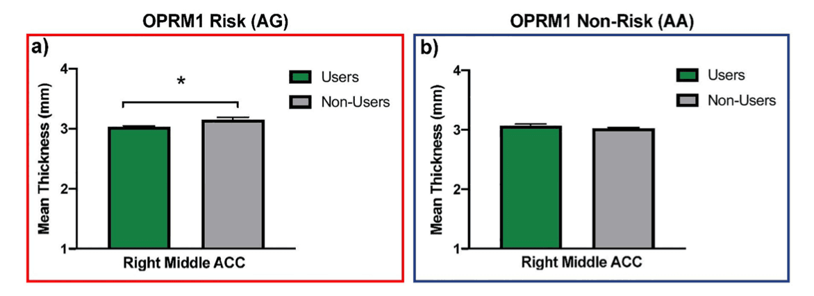 Figure 2. OPRM1 x use interaction on right middle ACC thickness.