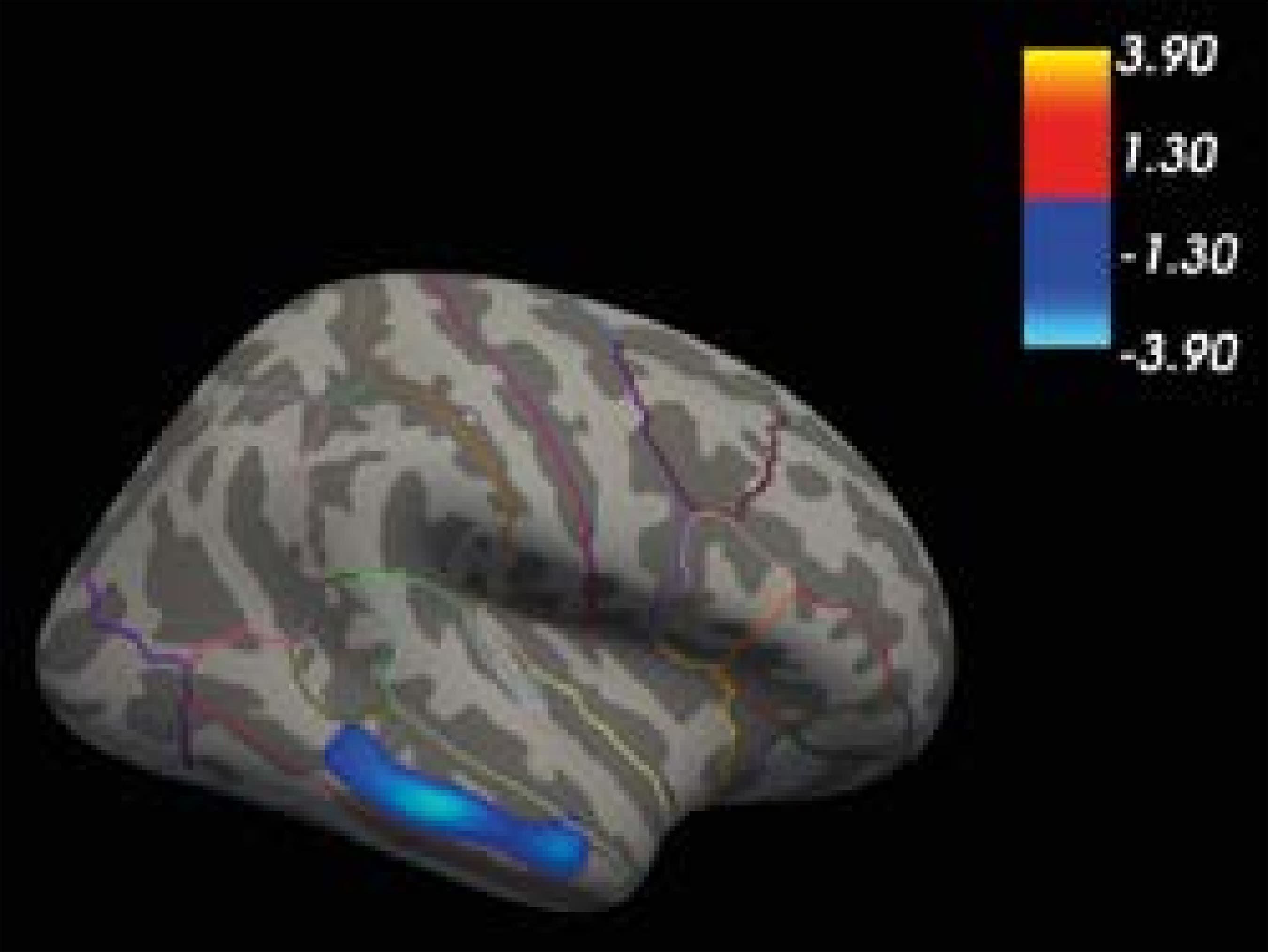 1889-1861-ejpalc-14-2-0093-gf01