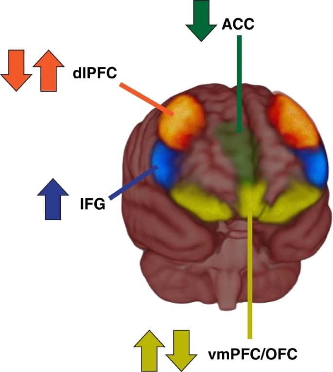 Fig. 3: The PFC mechanisms of recovery as supported by the iRISA framework.