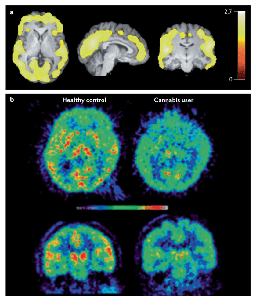 Fig. 4. PET imaging of CB1 receptors and FAAH.