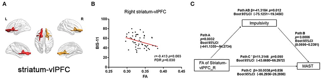 Figure 4. Correlation between FA of striatal circuits and impulsivity and mediation role.